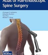 atlas of full endoscopic spine surgery