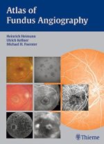 atlas of fundus angiography