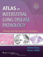 atlas of interstitial lung disease pathology: pathology with high resolution ct correlations