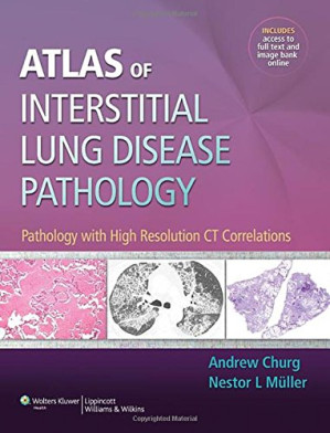 atlas of interstitial lung disease pathology: pathology with high resolution ct correlations