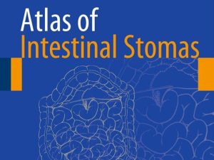atlas of intestinal stomas