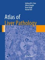 atlas of liver pathology