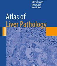 atlas of liver pathology