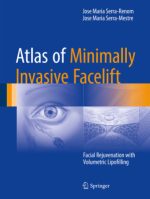 atlas of minimally invasive facelift