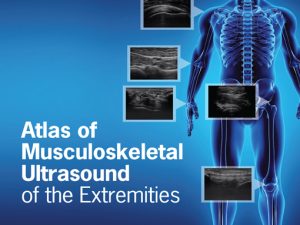 atlas of musculoskeletal ultrasound of the extremities 1st edition