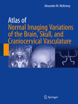 atlas of normal imaging variations of the brain, skull, and craniocervical vasculature