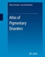 atlas of pigmentary disorders
