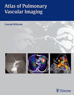atlas of pulmonary vascular imaging