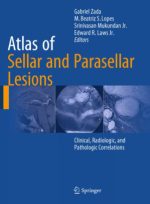 atlas of sellar and parasellar lesions: clinical, radiologic, and pathologic correlations