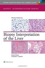 biopsy interpretation of the liver (biopsy interpretation series)