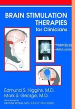 brain stimulation therapies for the clinician