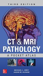 ct & mri pathology: a pocket atlas, 3rd edition (june 2018 release)