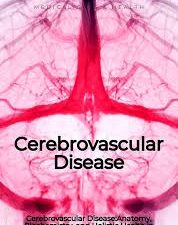 cerebrovascular disease
