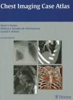 chest imaging case atlas 2nd edition