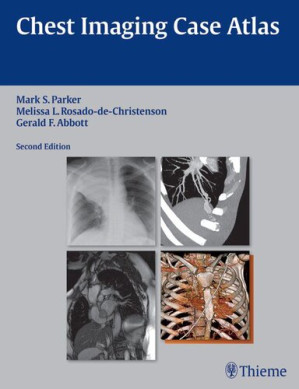 chest imaging case atlas – 2nd edition