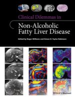 clinical dilemmas in non alcoholic fatty liver disease