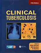 clinical tuberculosis, 5th edition (2014)