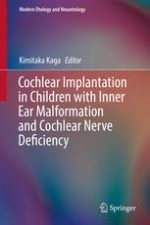 cochlear implantation in children with inner ear malformation and cochlear nerve deficiency