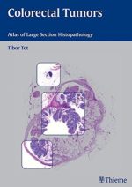 colorectal tumors: atlas of large section histopathology