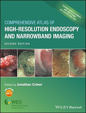 comprehensive atlas of high resolution endoscopy and narrowband imaging