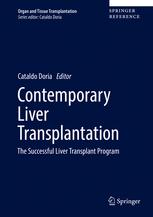 contemporary liver transplantation: the successful liver transplant program (organ and tissue transplantation)