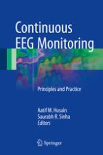 continuous eeg monitoring: principles and practice