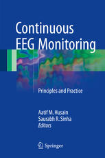 continuous eeg monitoring: principles and practice