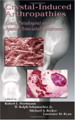 crystal induced arthropathies: gout, pseudogout and apatite associated syndromes