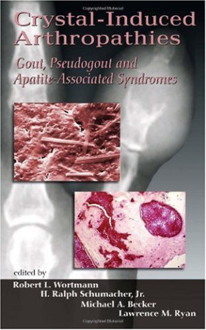 crystal induced arthropathies: gout, pseudogout and apatite associated syndromes