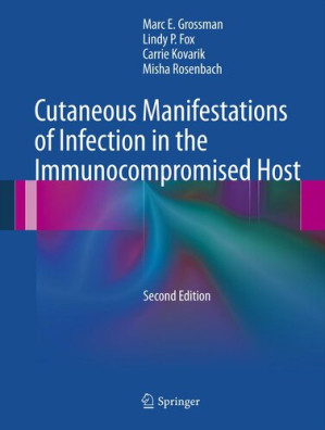cutaneous manifestations of infection in the immunocompromised host (2nd edition)
