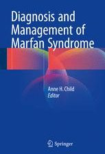 diagnosis and management of marfan syndrome
