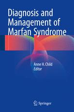 diagnosis and management of marfan syndrome