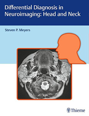 differential diagnosis in neuroimaging: head and neck