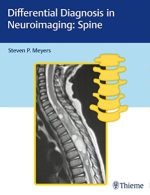 differential diagnosis in neuroimaging: spine 1st edition