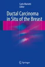 ductal carcinoma in situ of the breast