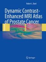 dynamic contrast enhanced mri atlas of prostate cancer