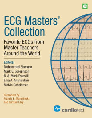 ecg masters collection: favorite ecgs from master teachers around the world