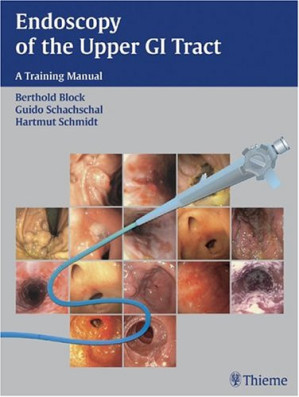 endoscopy of the upper gi tract: a training manual