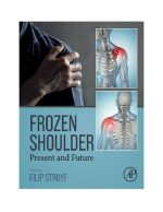 frozen shoulder