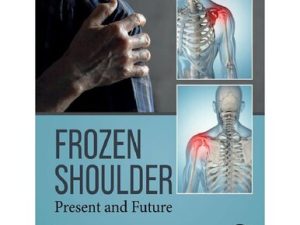 frozen shoulder