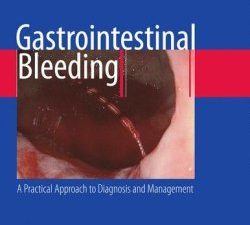 gastrointestinal bleeding: a practical approach to diagnosis and management