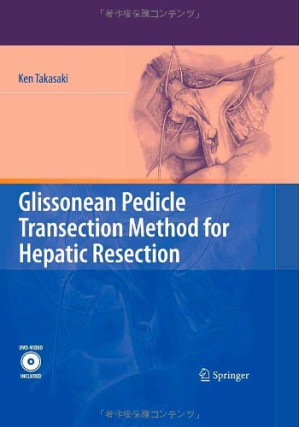 glissonean pedicle transection method for hepatic resection