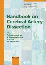handbook on cerebral artery dissection (frontiers of neurology and neuroscience)