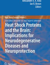 heat shock proteins and the brain: implications for neurodegenerative diseases and neuroprotection