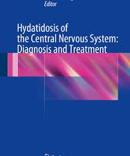 hydatidosis of the central nervous system: diagnosis and treatment