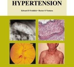 hypertension (atlas of investigation and management)