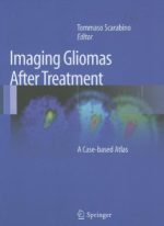 imaging gliomas after treatment: a case based atlas