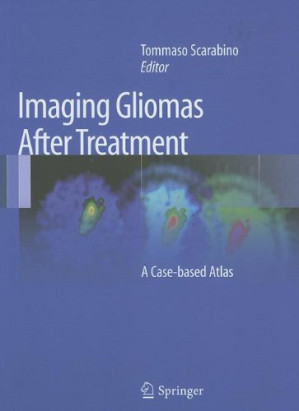 imaging gliomas after treatment: a case based atlas