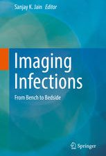 imaging infections: from bench to bedside (july 2017 release)
