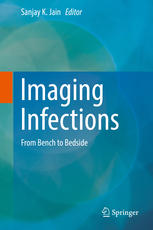 imaging infections: from bench to bedside (july 2017 release)